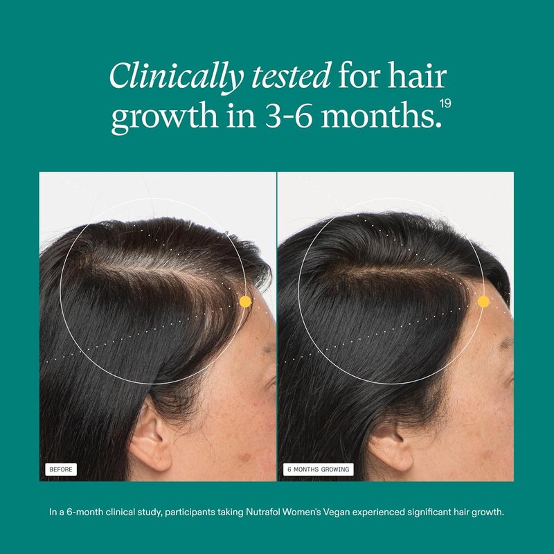 Nutrafol Women's Hair Growth Supplements | Clinically Tested for Thicker, Stronger Hair - 2 Month Supply, Vegan