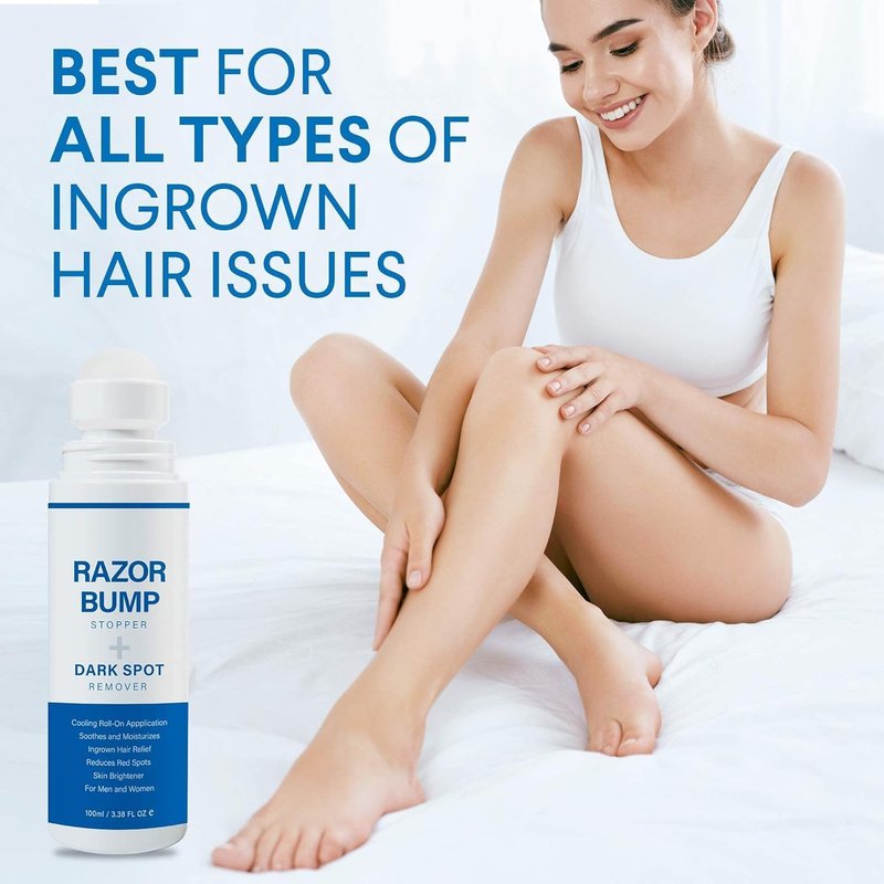Razor Bump Stopper - Ingrown Hair Treatment for Men & Women | After Shave Solution, 3.38 Fl Oz
