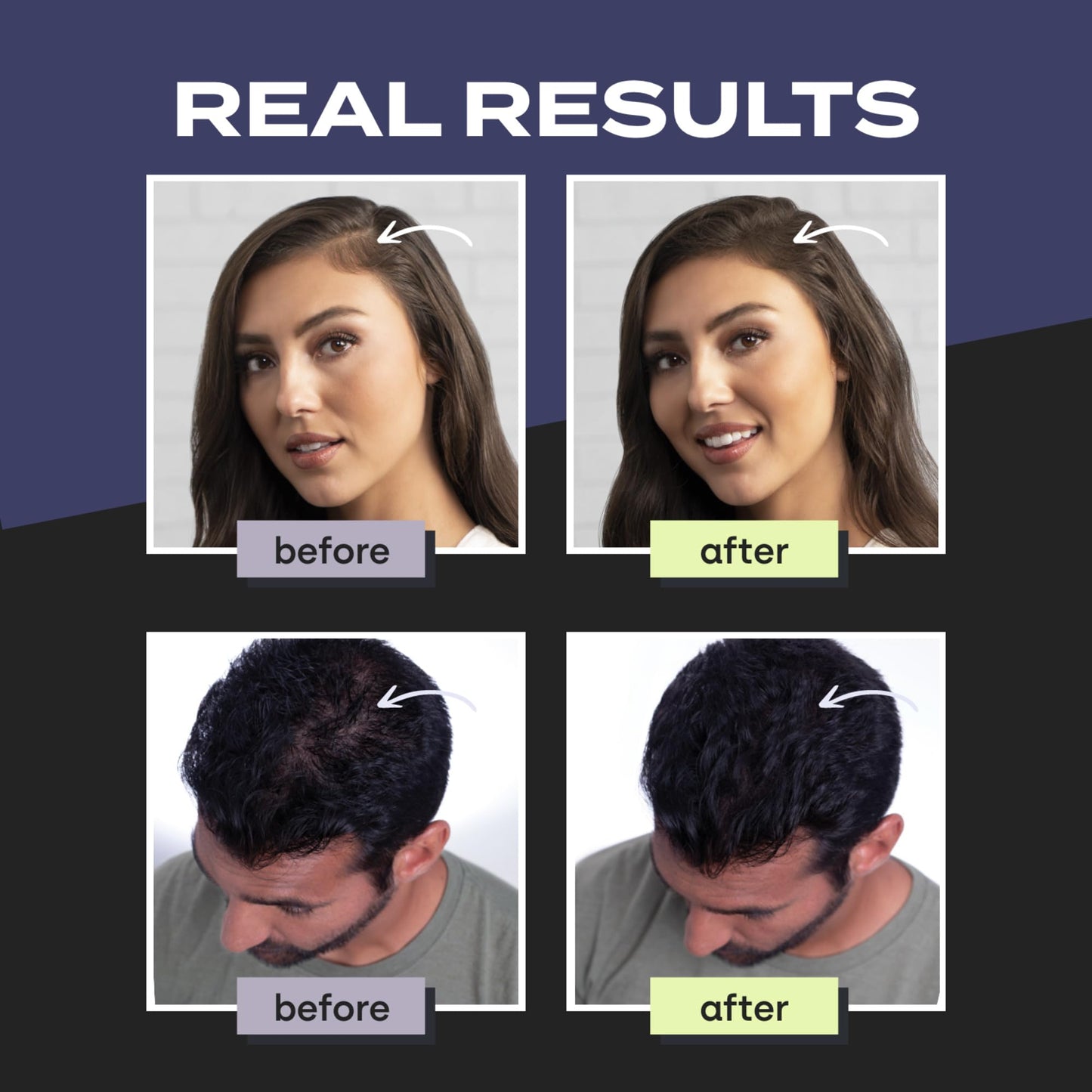 Toppik Hair Building Fibers, Dark Brown, 12g Fill In Fine or Thinning Hair, Instantly Thicker, Fuller Looking, 9 Shades for Men & Women, Keratin Protein Formula