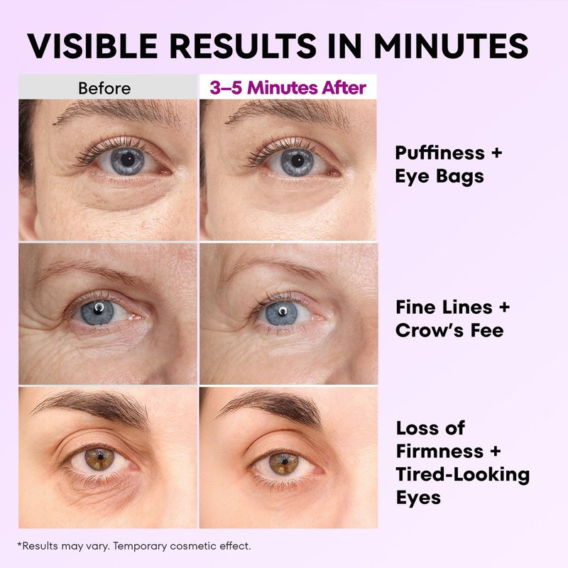 RONKIE Instant Firm Eye Tightener: Upgraded Formula for Women Helps Reduce Eye Bags Puffiness and Wrinkles in 3-5 Minutes When Time Matters 0.67 oz