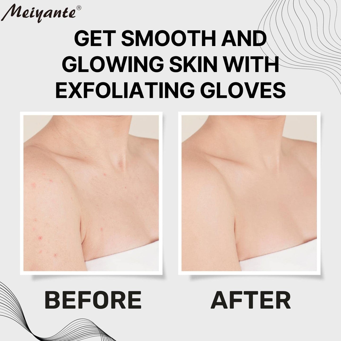 Meiyante Korean Exfoliating Mitts (2pcs) - Achieve Home Microdermabrasion with 100% Viscose Fiber Gloves for Silky Smooth Skin