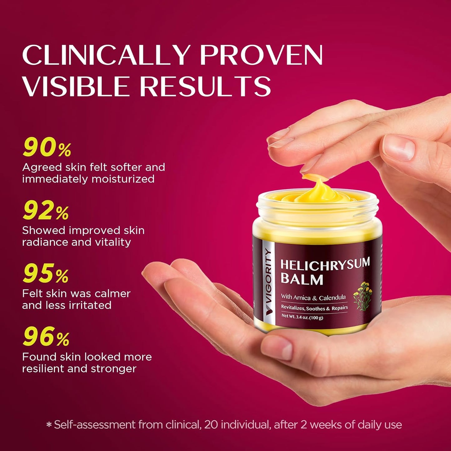 Vigority Helichrysum Balm Soothes & Repairs: Restorative Arnica Cream with Calendula for Bruised, Fragile & Thin Skin – Moisturizes, Revitalizes & Strengthens Skin Barrier for Adult Seniors - 3.4 oz