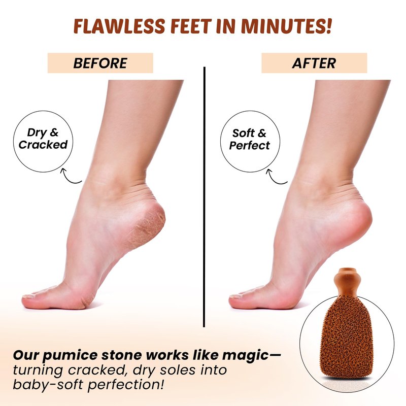 POHS Rectangular Pumice Stone – Callus Remover & Exfoliator for Feet & Body, Foot Scrubber for Shower, Natural Pumice Stone for Smooth Skin
