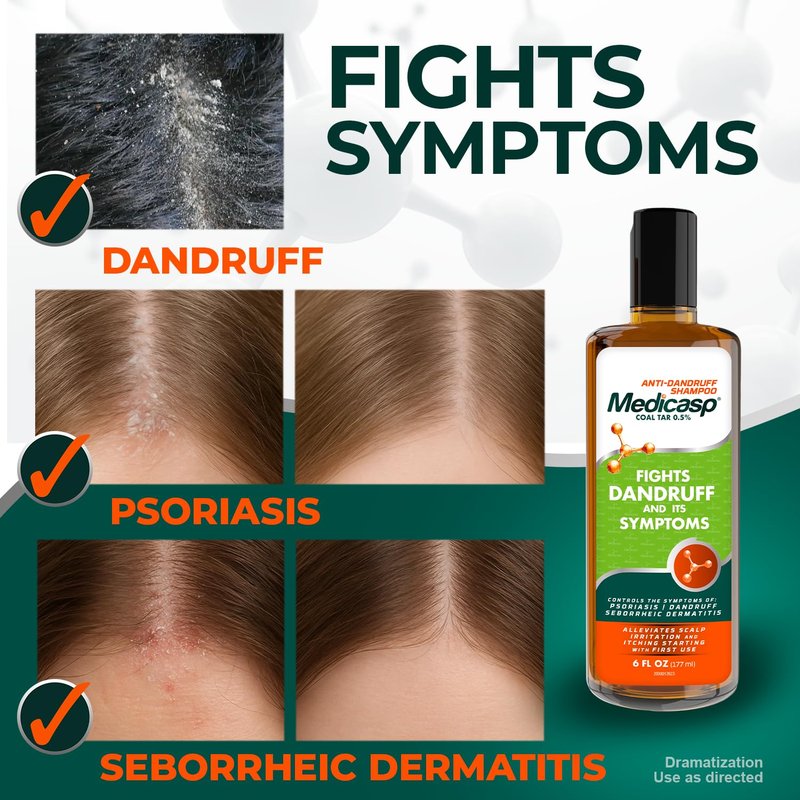 Coal Tar Anti-Dandruff Shampoo - Treats Psoriasis & Itchy Scalp | 6 Fl Oz