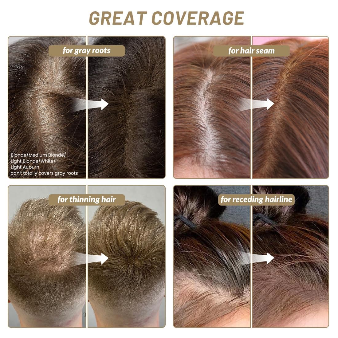 SOVONCARE Hairline Powder - Root Touch Up & Gray Hair Concealer for Men and Women, Instantly Covers Thinning Hair and Bald Spots, Natural-Looking Coverage Light Auburn