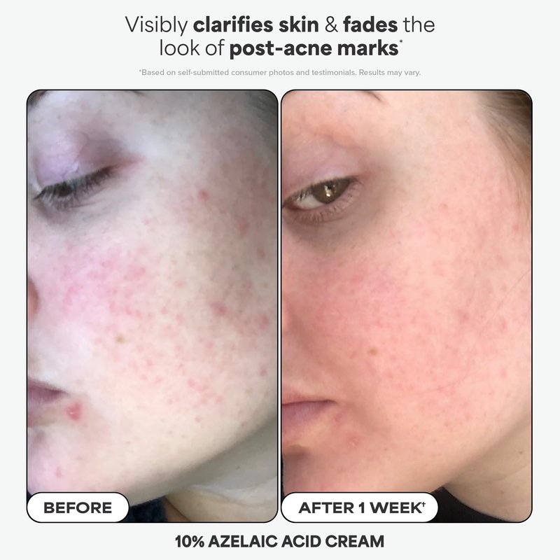 Paula's Choice Favorites Mini Kit, 4 Piece Set Includes 2% BHA Exfoliant, 1% Retinol Treatment, 10% Azelaic Acid Booster, Youth Extending SPF 50 Moisturizer, Travel Skin Care Set for Glowing Skin