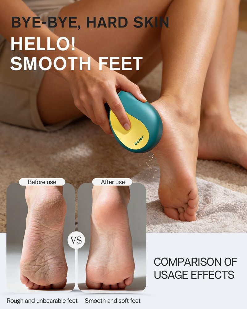 BEZOX Glass Foot Scrubber – Professional Foot File Callus Remover for Dead Skin & Cracked Heels – Premium Pumice Stone Pedicure Tools for Feet with Anti-Slip Handle and Protective Cover - Green