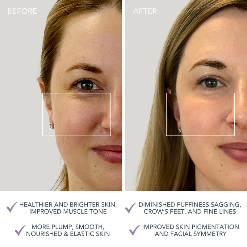 FOREO Bear mini App-Connected Microcurrent Facial Toning Device with 3 Intensities, Lavender