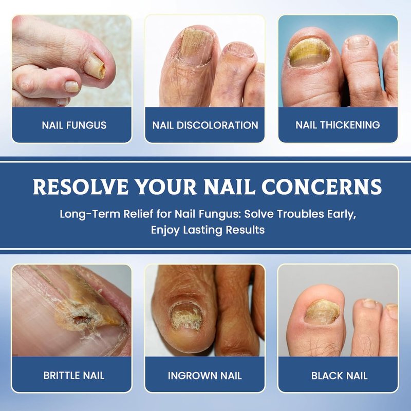 Skiennix Fungal Nail Patches - Extra Strength Toenail Fungus Treatment for Men & Women | 32 Pcs
