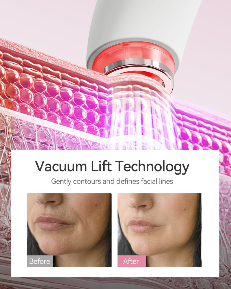 FliKEZE Red Light Therapy Device for Face and Neck, 3-in-1 Microcurrent & Vacuum Facial Massager, Skin Tightening, Firming and Anti-Aging Skincare Tool (White)