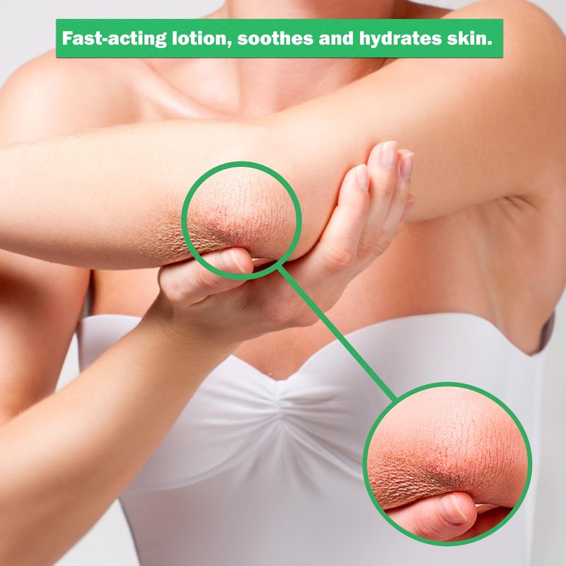 Dr. Dan's Hydrocortisone Hand and Body Lotion - Anti Itch Lotion for Men and Women - 1 Pack