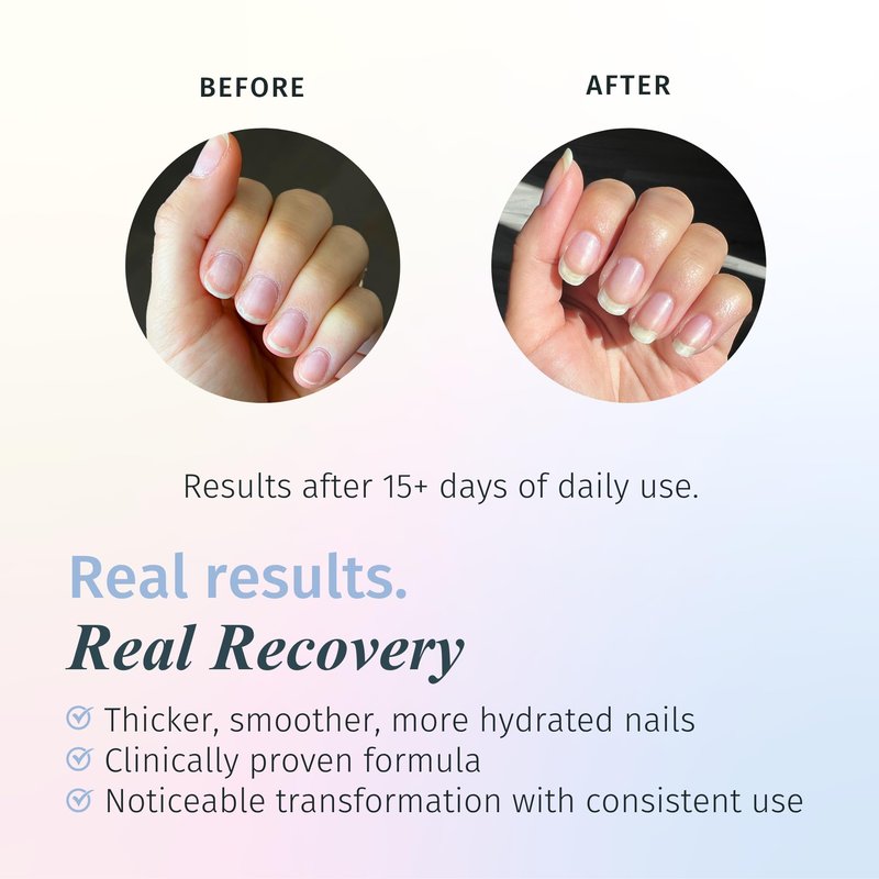 Duri Rejuvacote 1 Nail Growth System - Maximum Strength Nail Strengthener for Damaged Nails from Gel, Acrylic Manicure | Grow Long Natural Fingernails Fast - Rejuvacare Nail Hardener - 0.45 fl. oz.