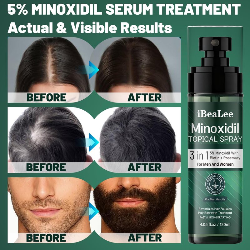 5% Minoxidil for Men - Minoxidil for Women Hair Growth Treatment Beard Growth Serum,Biotin & Rosemary to Fight Hair Loss, Strengthens Weak Roots, Repairs Thinning Hair