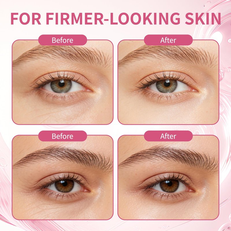 PDRN Pink Peptide Eye Serum Cream, Hydrating & Firming Eye Cream for Dark Circles, Anti-Aging Treatment Reduces Fine Lines, Uneven Skin Tone, Soothing Pink Moisturizer with Peptides, 1.01fl.oz (1)