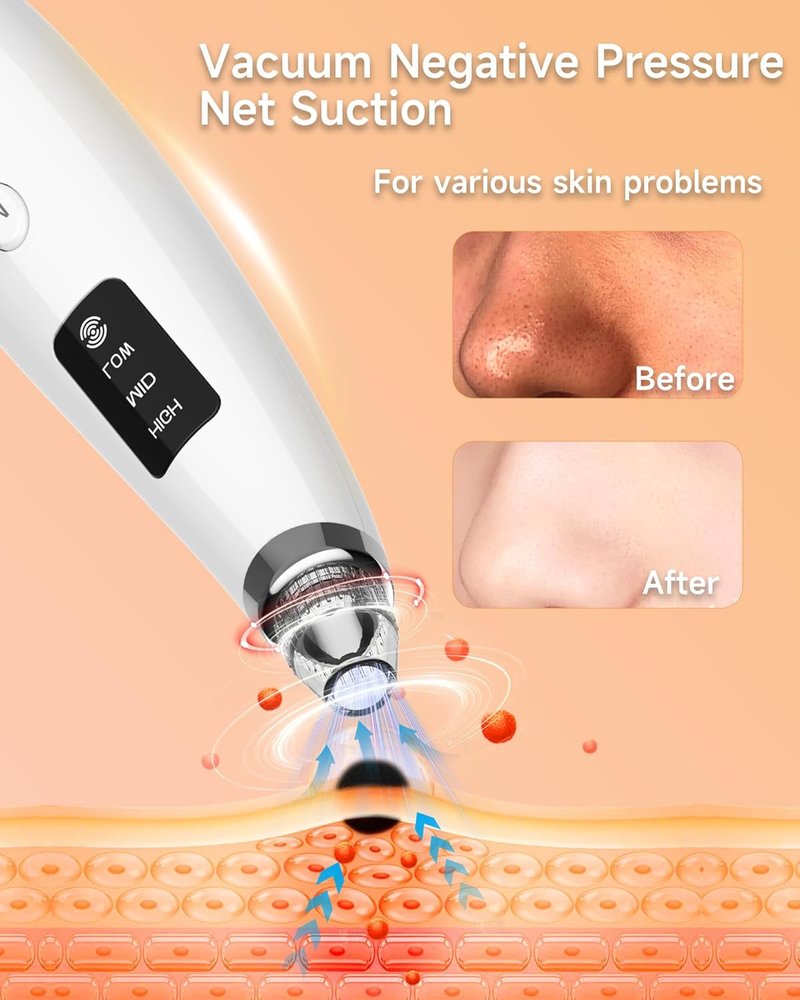 Blackhead Remover Vacuum - Type-C Rechargeable Pore Cleaner with 3 Suction Levels & 6 Probes | Face & Nose Comedone Extractor Tool (White)
