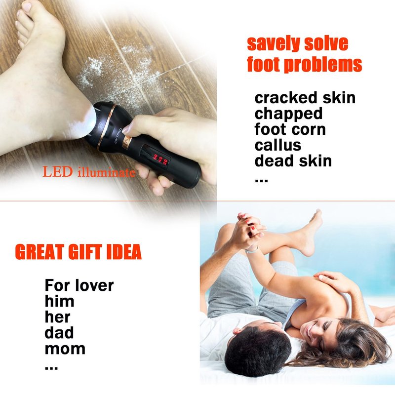 Electric Foot Callus Remover- Long Service Time, Rechargeable Electronic Foot File- Ideal Gift, Professional Pedicure Tools, Waterproof Foot Scrubber, Pedicure Kit Feet Care for Dead Skin (Black)