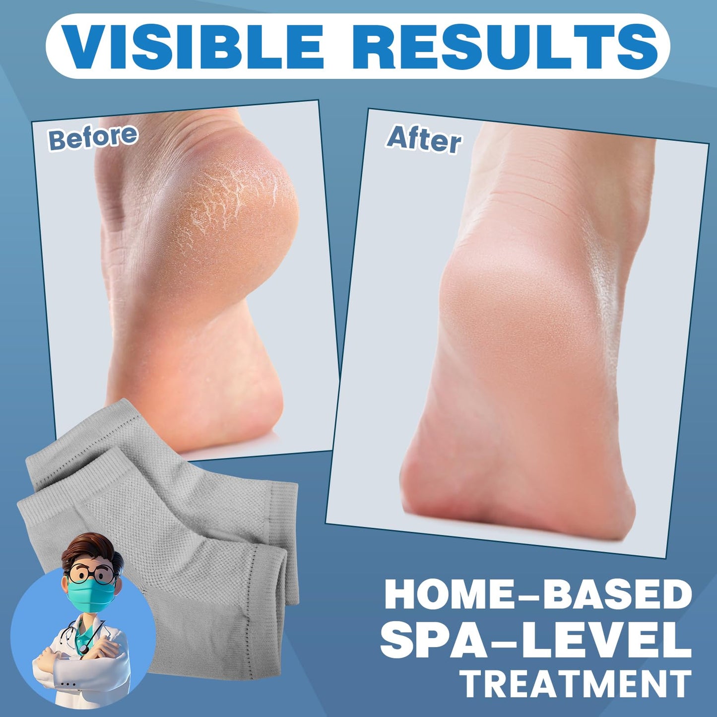 TEAWOO Moisturizing Heel Socks - 6 Pairs for Dry Cracked Feet, Toeless Gel Socks for Hydration and Repair