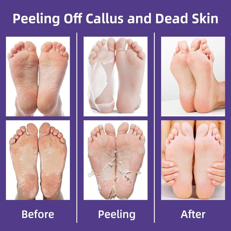 GUOYAOLIFU Hydrating Foot Masks Set,Exofliating 6 Pack Socks Mask for Dry Feet Peeling Away Dead Skin Calluses（Lavender）