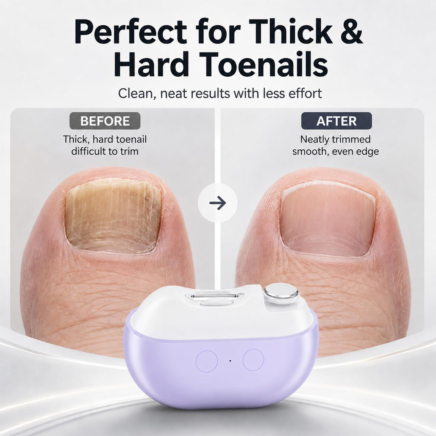 Whriou 3-in-1 Electric Nail Clipper for Seniors – 40dB Quiet, Rechargeable Automatic Trimmer for Thick Toenails, LED Light, Portable Grooming Tool for Elderly Men Women（Purple）