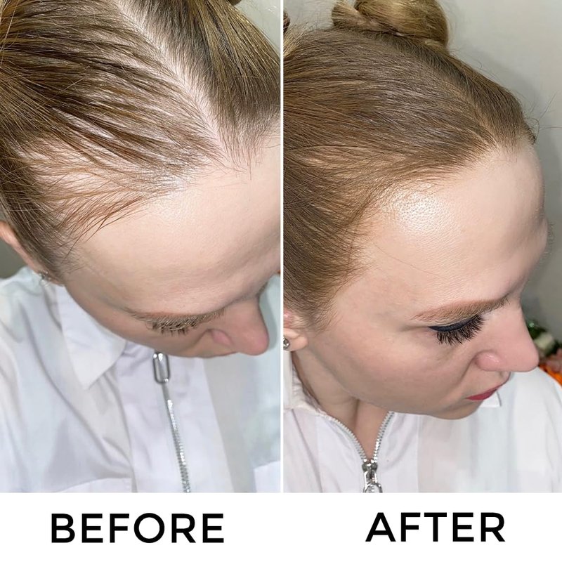 Root Touch Up Hair Color Spray - Temporary Gray Coverage | Ammonia-Free, Quick Drying, Water-Resistant, Black