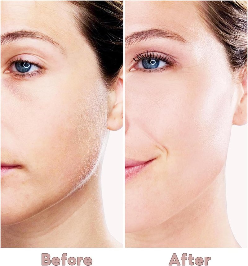 Facial Hair Removal for Women - Electric Painless Remover with USB Rechargeable & 2 Heads | Rose Gold