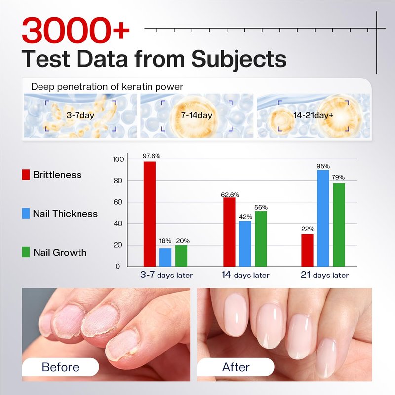 Morovan Nail Strengthener and Growth: Milky White Nail Polish Hardener Ridge Filler, Nail Repair for Damaged Nails, Natural Keratin Strengthening Polish and Concealer, Nail Care for women