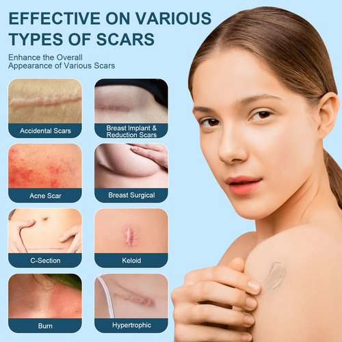 Advanced Scar Gel, Silicone Scar Gel, Treats Old and New Scars, Reduces the Appearance of Scars from, Body, Face, Stretch Marks, Surgical Scar, Keloids, Acne, Burns and More, 50g (1.76 Oz)