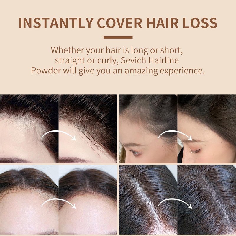 Sevich Hairline Powder,Instantly Conceals Hair Loss, Root Touch up Powder, Hair Shadow Toppers for Women & Men, Touch Up for Thinning Gray Hair, Windproof & Sweatproof,Medium brown