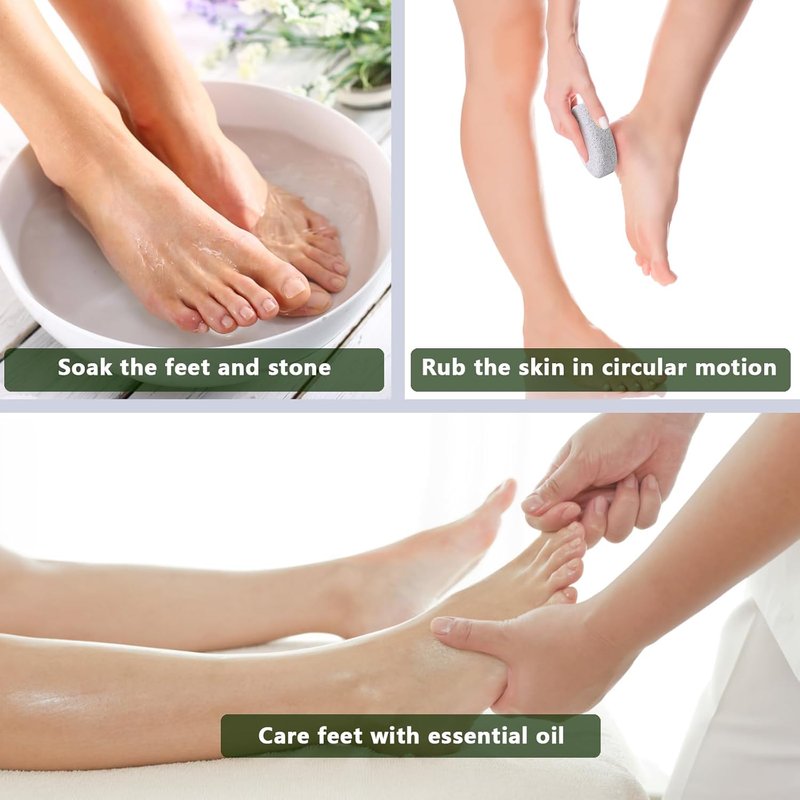 Borogo Pumice Stone Set - 8-Pack Natural Lava Pedicure Tools for Hard Skin & Callus Removal