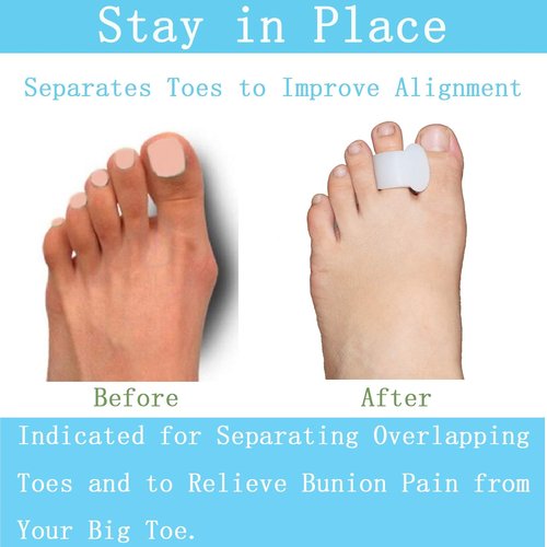 Pack of 12 Gel Toe Separator, (1/4" Thick) Big Toe Spacers, Single Loop Toe Spreader for Bunions, Overlapping Toe, Corrector and Spacer (Clear)