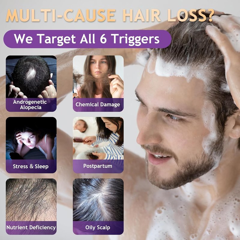 Biotin Hair Growth Shampoo - Sulfate-Free Thickening Formula for All Hair Types | 10.1 Fl Oz