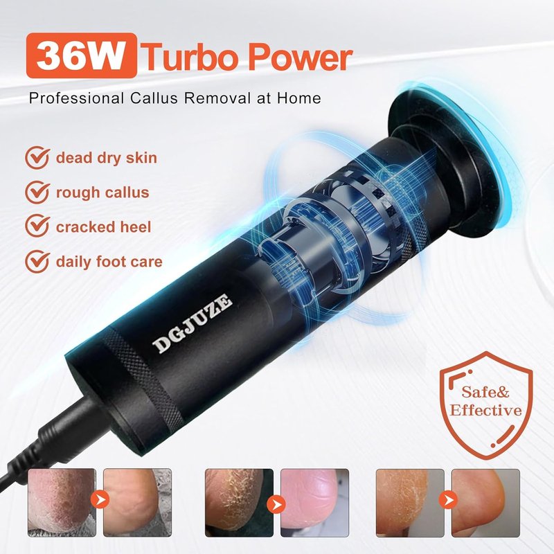 PowerPro Electric Foot Callus Remover - 36W Heavy Duty Metal Grinder for Smooth Feet | 60 Sandpaper Pads Included
