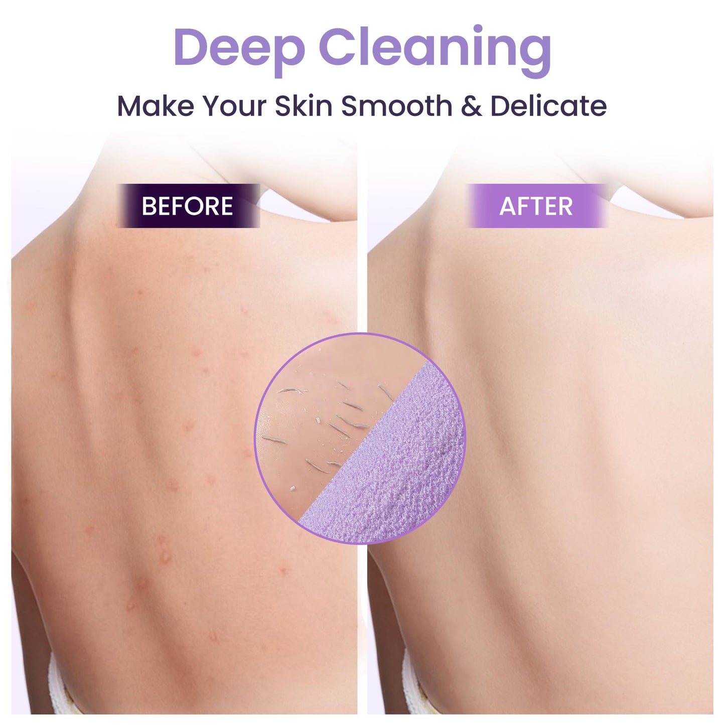 3 Pcs Double-Sided Back Exfoliator Body Scrub Towel, Exfoliating Back Scrubber with Handles,Exfoliating Washcloth Bath Tool in Shower, Stretchable Back Washer to Deep Cleans Skin (Purple)