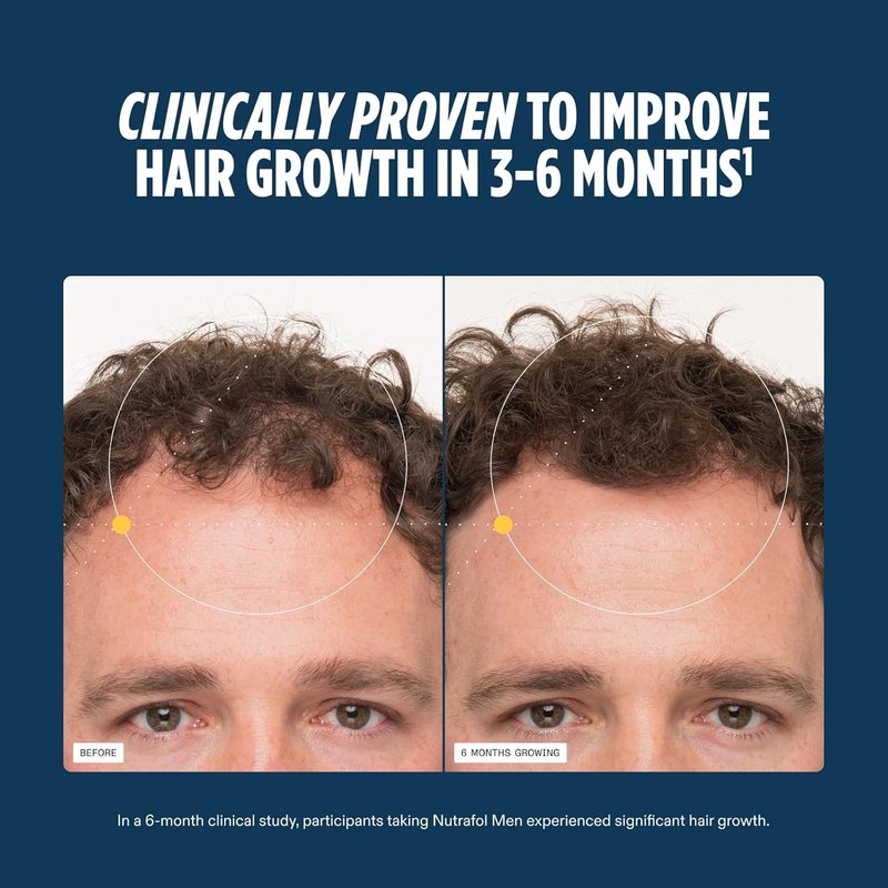 Nutrafol Men's Hair Growth Supplements - Clinically Tested for Thicker Hair & Scalp Coverage | 3 Month Supply (Pack of 3)