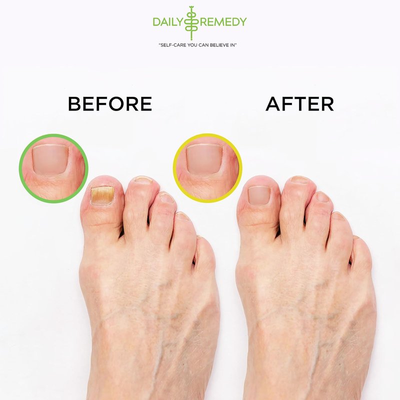DAILY REMEDY Tea Tree Oil & Citrus Foot Soak Set, Pack of 2, for Foot Pain, Odor, Sore Feet, Athlete’s Foot, Soften Calluses - Natural Blend & Salts, Made In USA