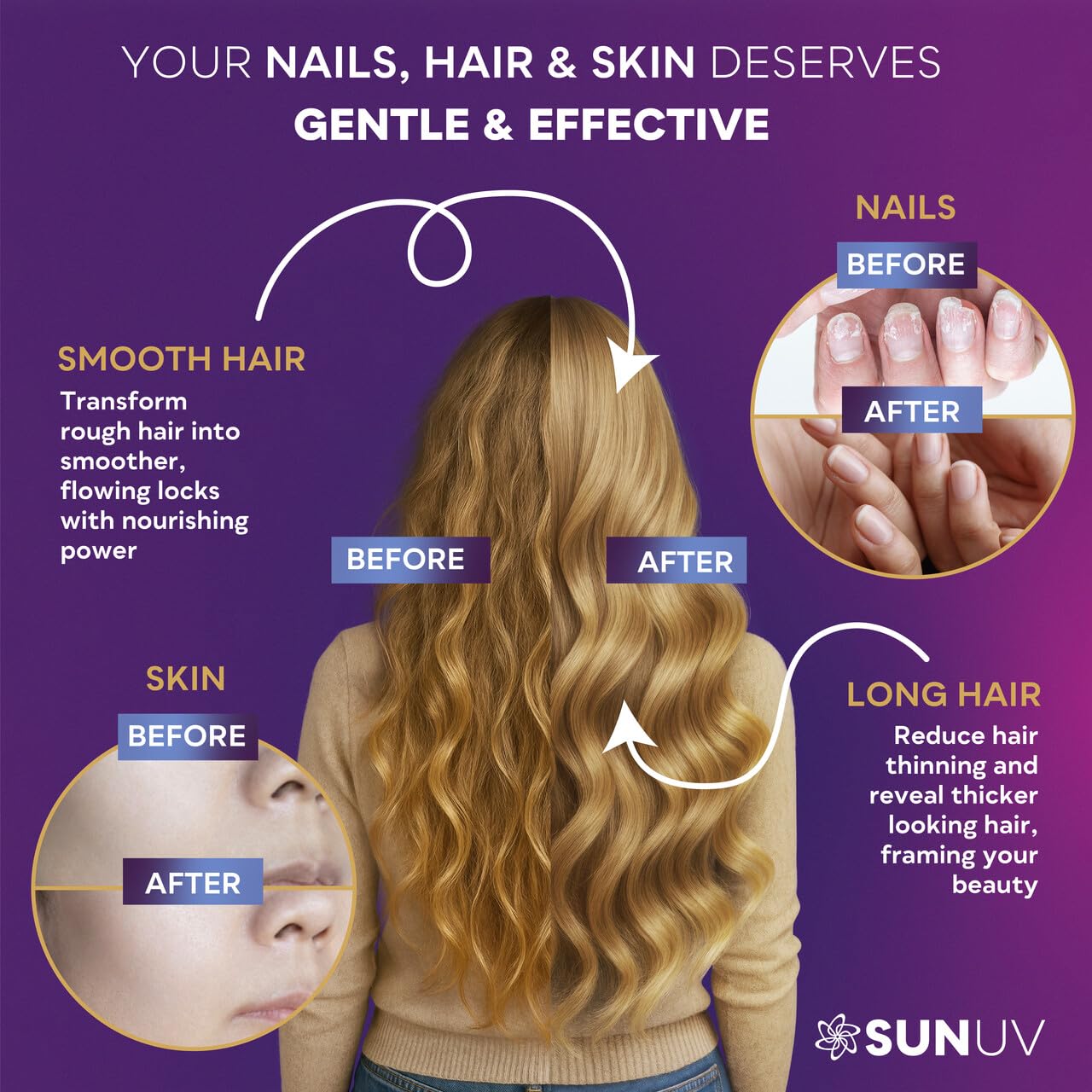 SUNUV Biotin 10,000mcg | Collagen | Keratin | Hyaluronic Acid - 80,000mcg Hair Growth Vitamins for Hair Skin & Nails Support - Women & Men - Vitamins B1,B2,B3,B5,B6,B9,B12 -Made in USA-90 Capsules