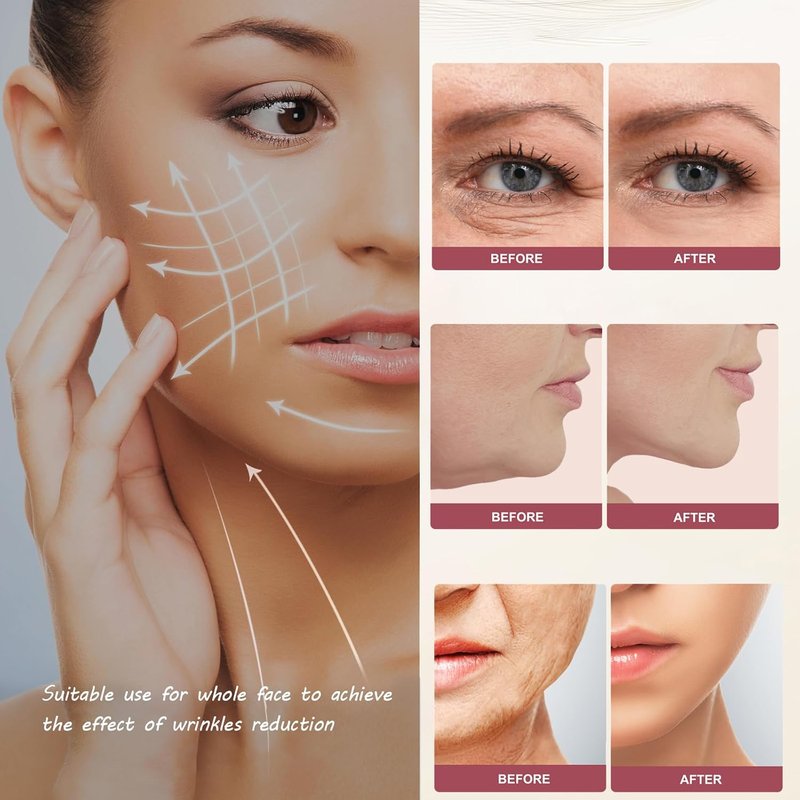 RF Skin Rejuvenator - Non-Wireless LED Light Therapy for Face & Body Wrinkle Reduction