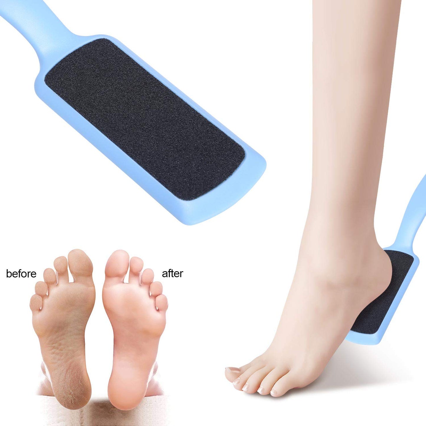 6 Pcs Pedicure Foot File Callus Remover with Double Sided Foot Rasp for Dead Skin Foot Scrubber for Feet