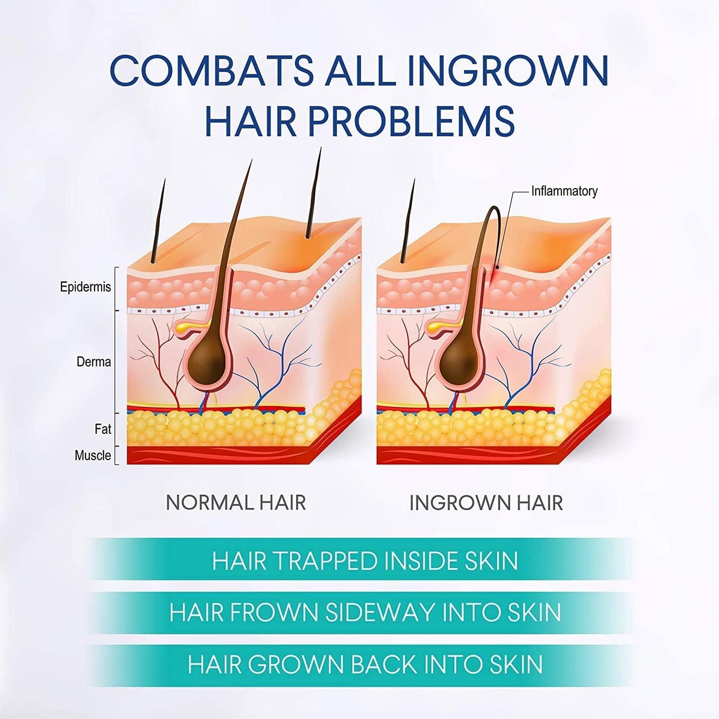Skiennix Razor Bump Treatment - Effective Ingrown Hair Solution for Bikini, Face, Neck & Legs