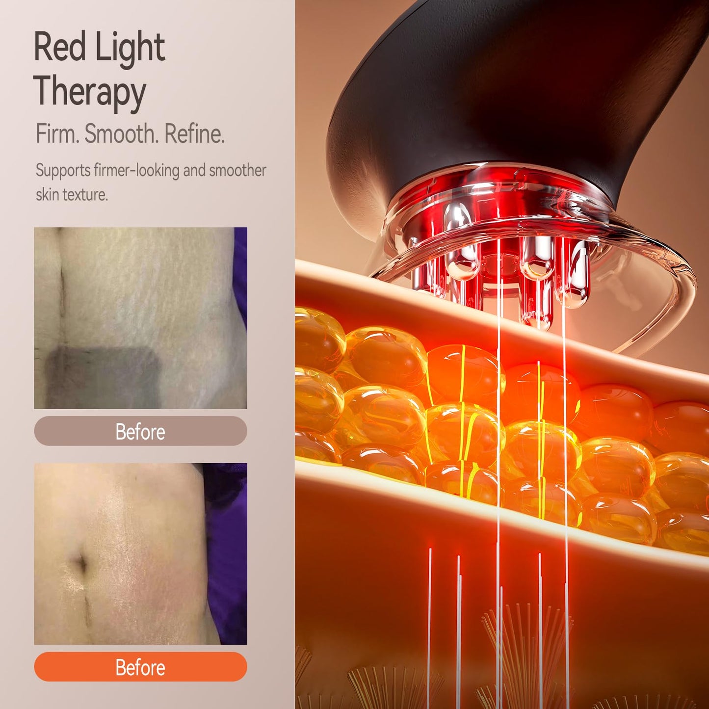 Zelvory 3-in-1 Body Sculpting Machine with Red Light, Vacuum Suction & Microcurrent, Cellulite Massage Tool for Arms, Legs, Waist & Belly, Skin Smoothing and Contouring Device for Home Use