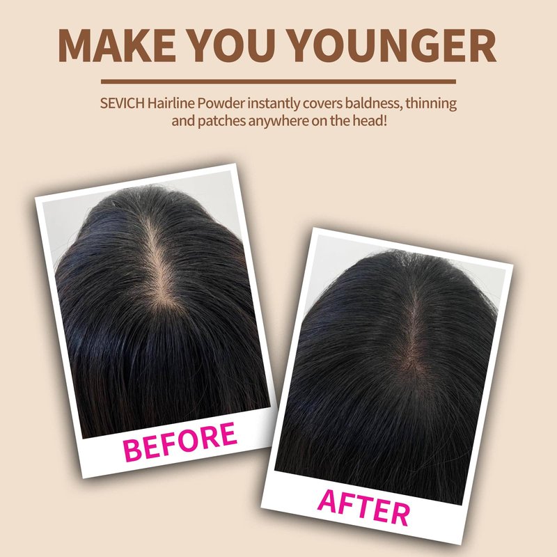 Sevich Hairline Powder,Instantly Conceals Hair Loss, Root Touch up Powder, Hair Shadow Toppers for Women & Men, Touch Up for Thinning Gray Hair, Windproof & Sweatproof,Medium brown