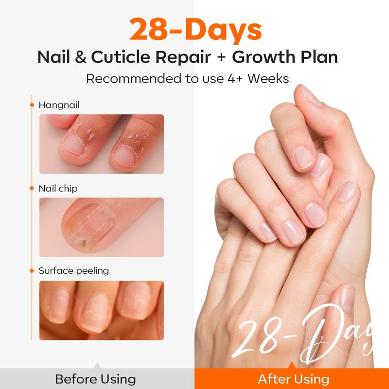 modelones Cuticle Oil Pen Rose for Growth and Strength Nail Growth Oil Cuticle Softener Quick Dry Nail Care Moisturize and Strengthen Damaged Nails 10ml 0.34Fl Oz