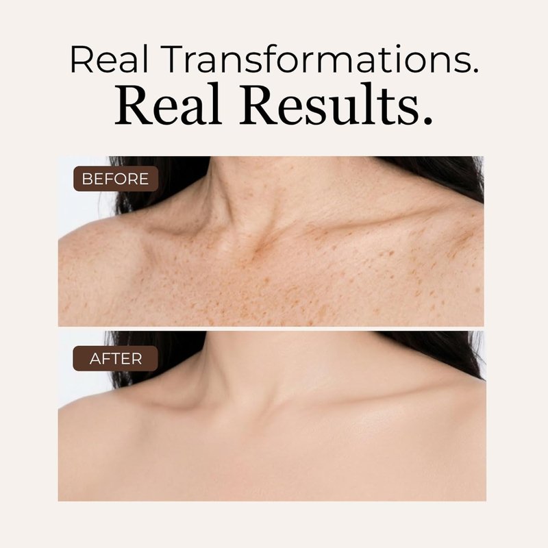 LUMINESS Airbrush Body Coverage Perfector - Waterproof Tattoo Concealer & Full Coverage Foundation | 18-Hour Wear