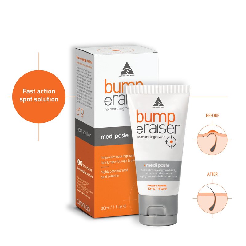 Bump eRaiser Medi Paste 1.0 fl oz — Tea Tree & Vitamin A Overnight Spot Treatment for Ingrown Hairs & Razor Bumps on Bikini Line, Legs, Beard & Underarms | Made in Australia