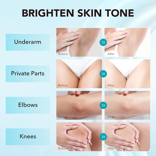 Skin Lightening Cream, Dark Spot Remover for Face Body Bleaching Cream for Intimate Areas & Body, Vitamin C Whitening for Underarms, Knees, Elbows, Inner Thighs, Bikini Line (1.7 Fl Oz)