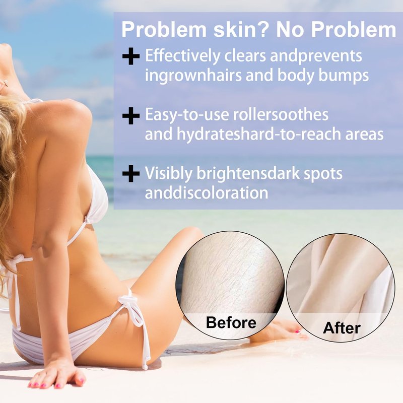 Ingrown Hair Treatment Serum - Smoothing Solution for Razor Bumps & Bikini Line | Soothing Aftercare for Soft Skin