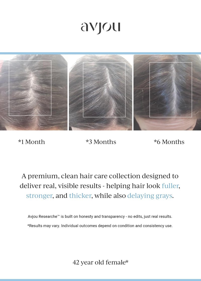 Avjou Researche™ Scalp Serum – Thicker, Fuller-Looking Hair + Targets Visible Signs of Premature Greying – 3 Patented Ingredients – Backed by Cosmetic Science – Oil-Free, All Hair Types, 1.7 oz