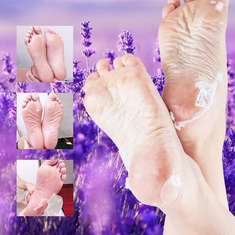 Exfoliating Foot Peel Mask - 5 Pack for Dry, Cracked Feet | Lavender & Shea Butter, Softens Skin