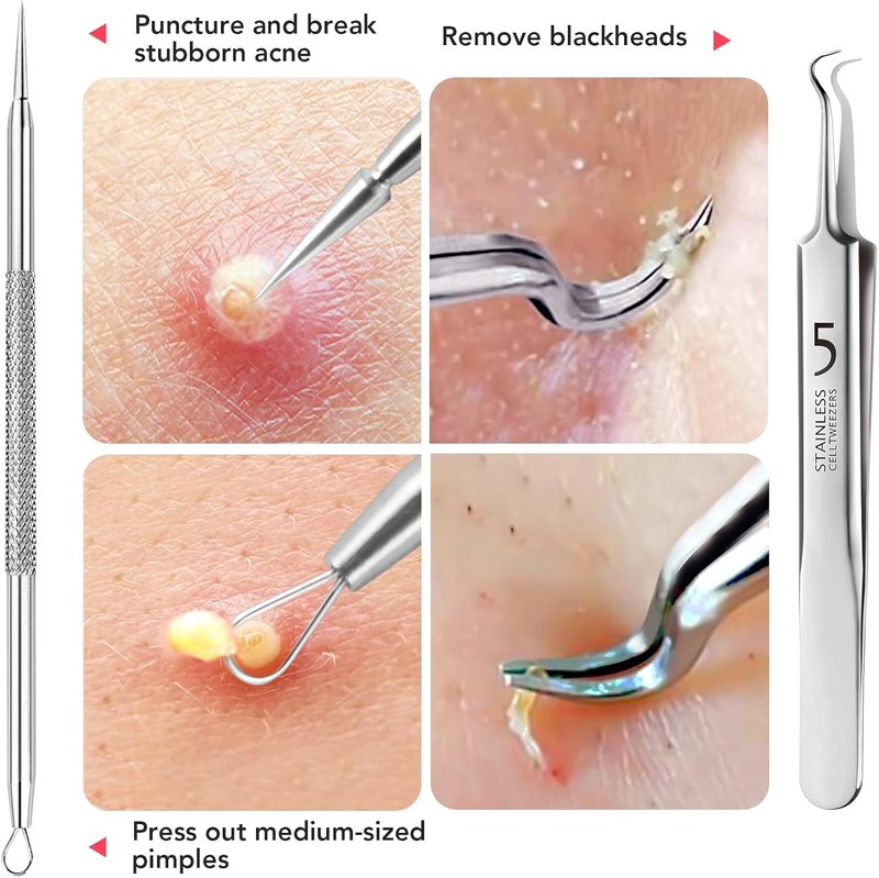 Litbear Blackhead Remover Tool Kit - 6 Pcs Acne Extractor Set with Leather Case for Deep Cleansing