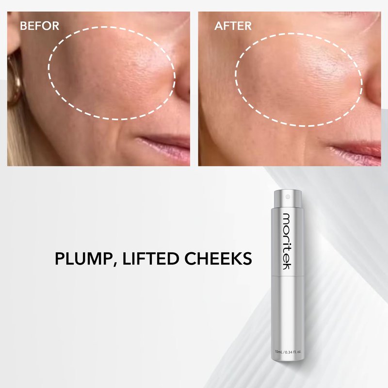 MORITEK Anti-Wrinkle & Lifting Essence Mist for Sensitive, Dry & Aging Skin – to Firm, Hydrate, Brighten and Visibly Reduce Wrinkles | Can be used over makeup |10ml